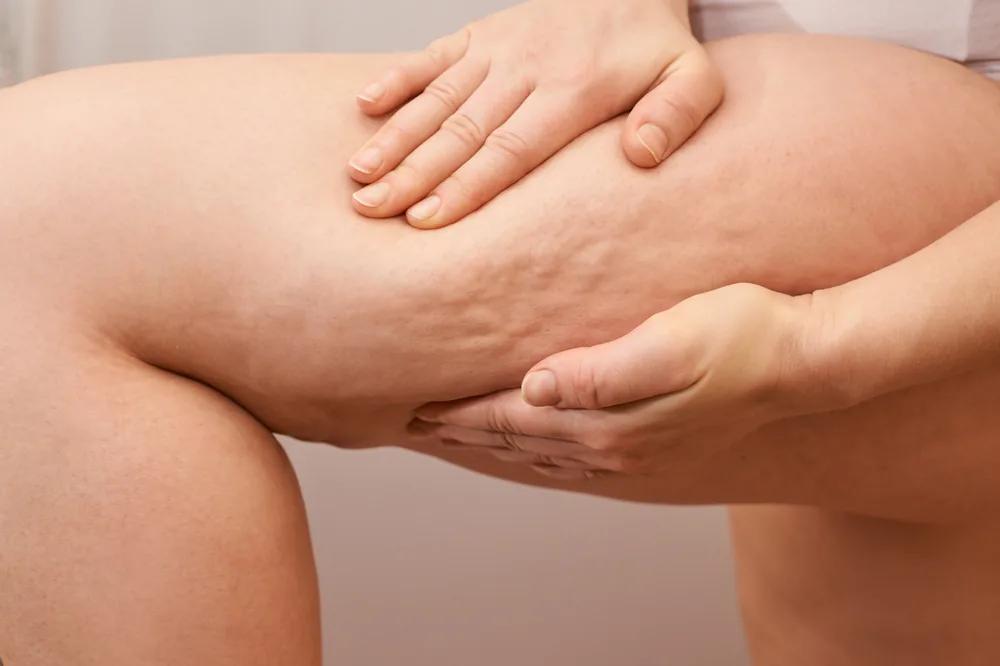 Estética corporal na Clínica Ávila